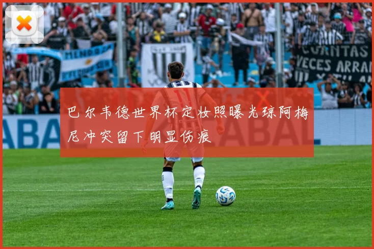 巴尔韦德世界杯定妆照曝光琼阿梅尼冲突留下明显伤痕